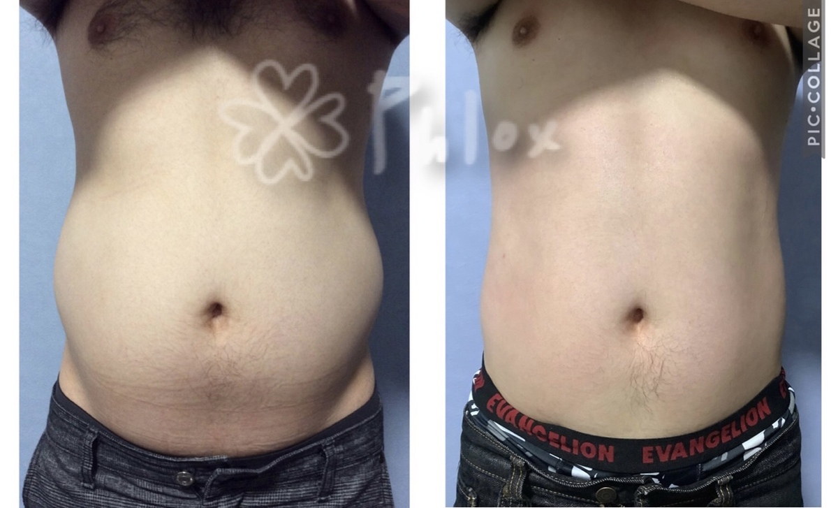 プレミアム痩身　モニター画像